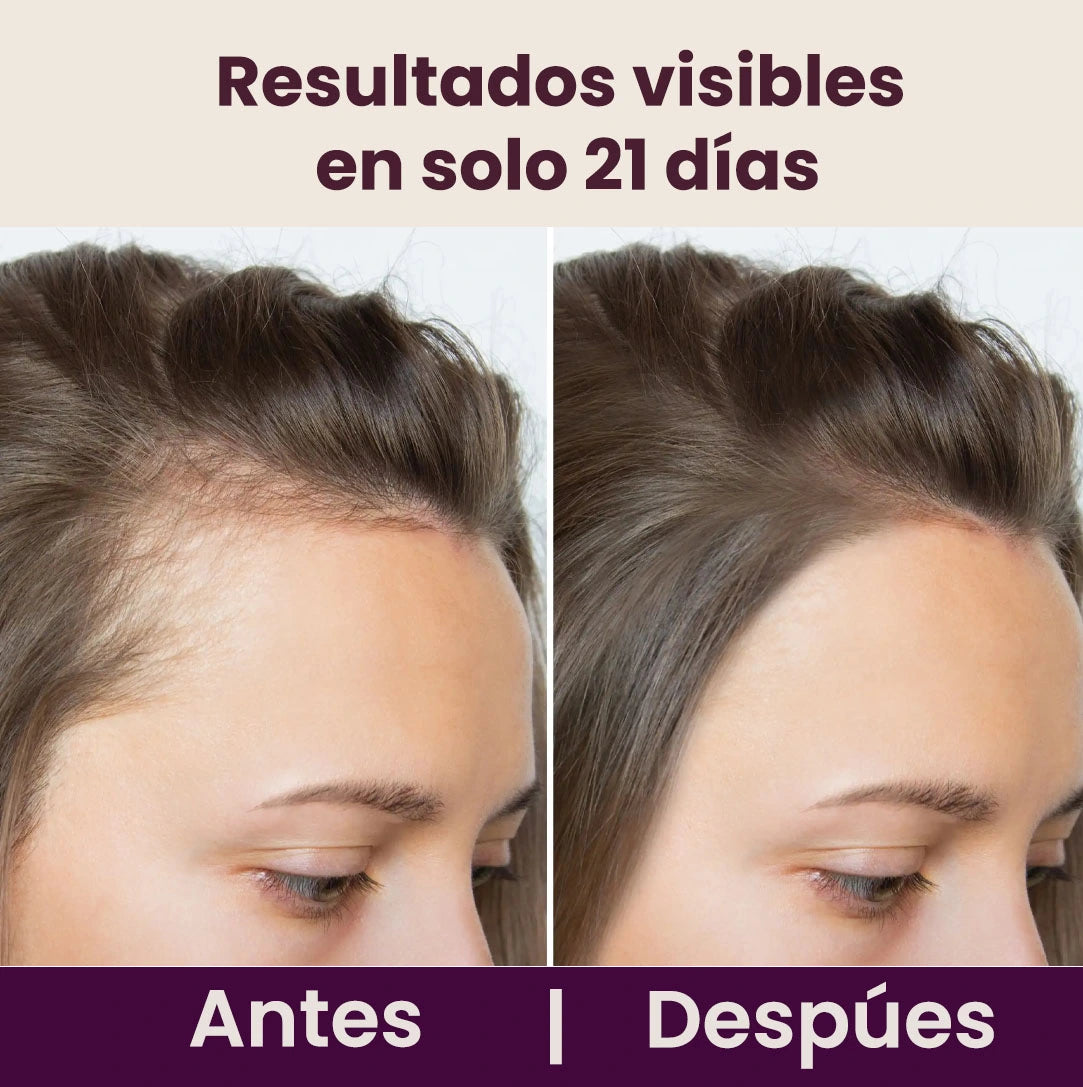 Estrés diario + mala Alimentación = 😖💥 cabello frágil.