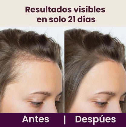 Estrés diario + mala Alimentación = 😖💥 cabello frágil.